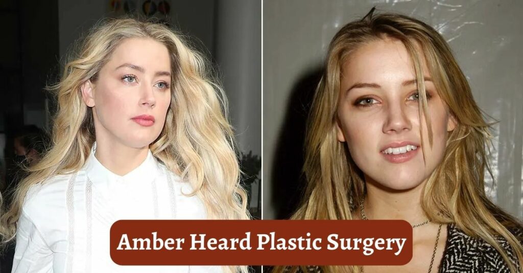 Amber Heard Plastic Surgery