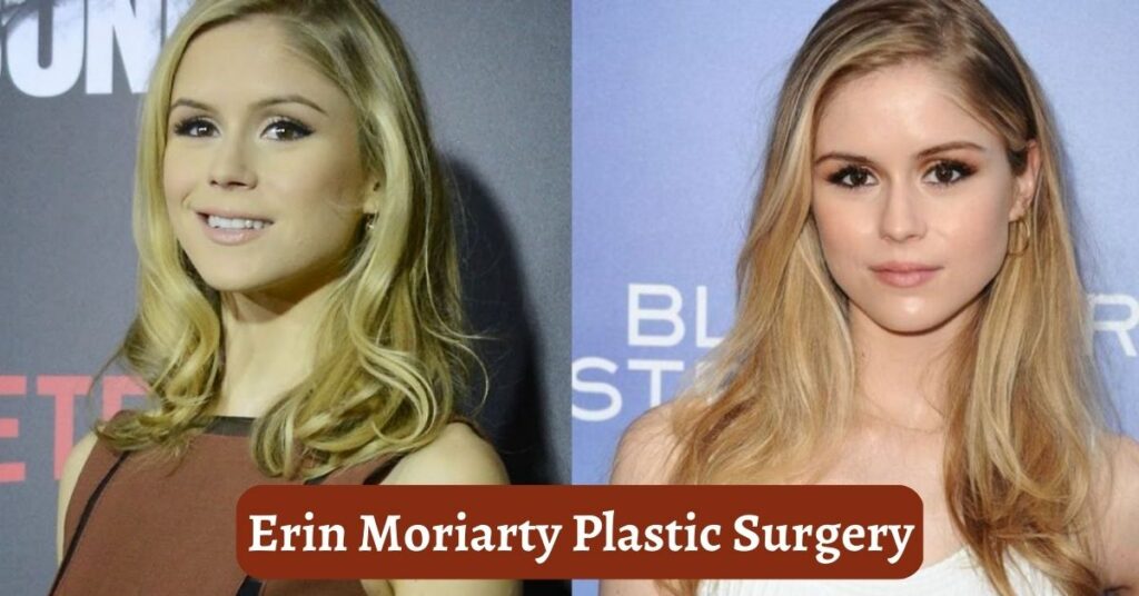 Erin Moriarty Plastic Surgery