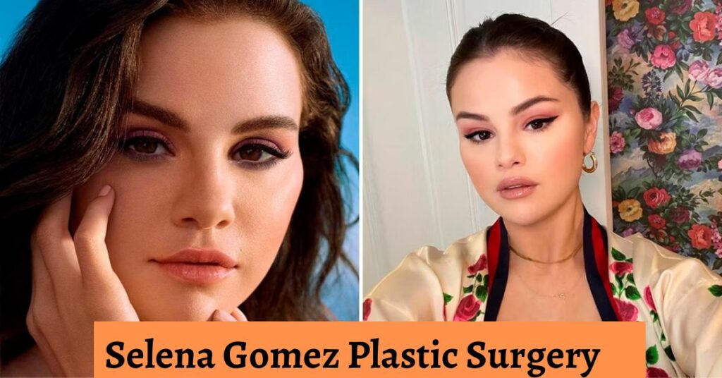 Selena Gomez Plastic Surgery