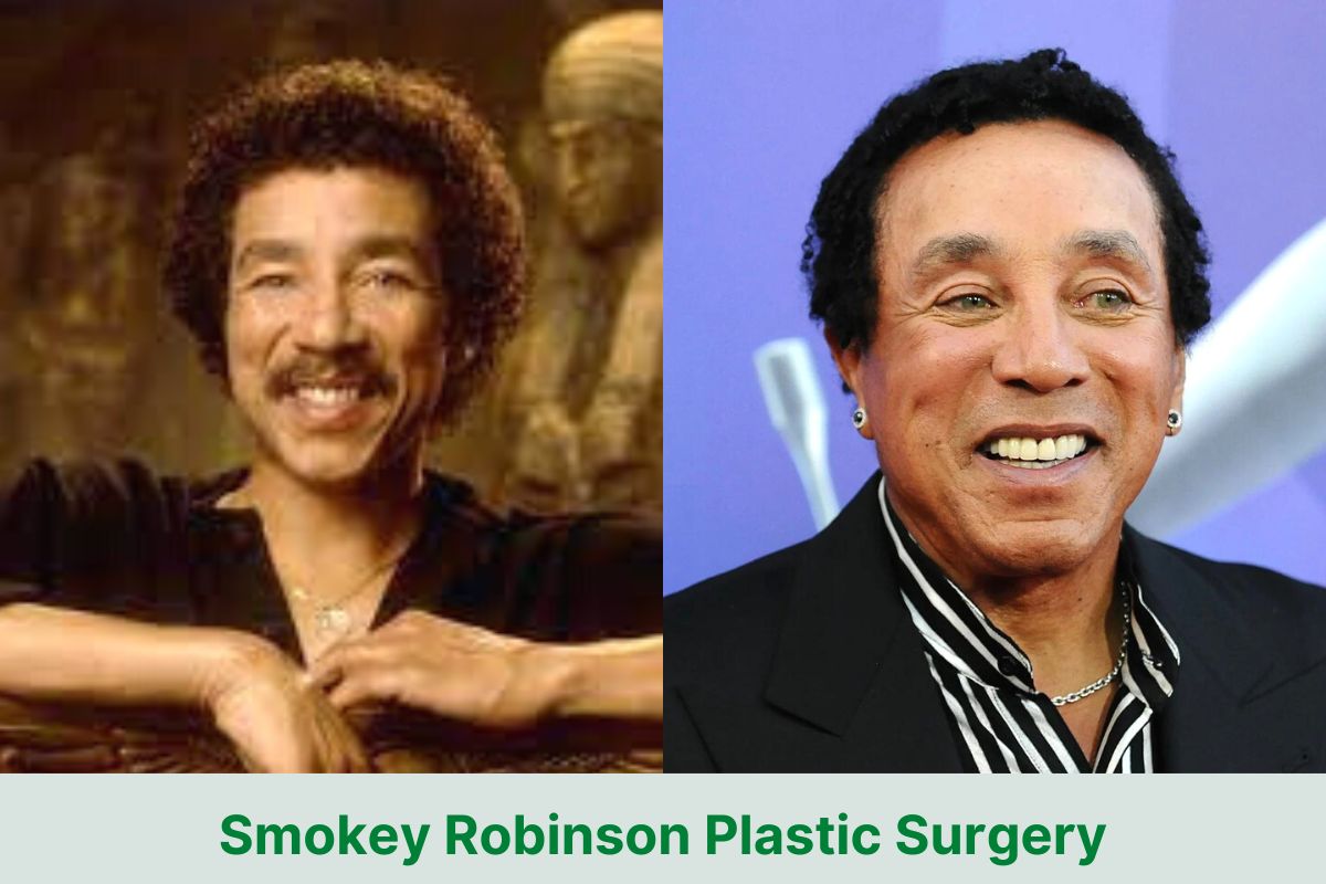 Smokey Robinson Plastic Surgery