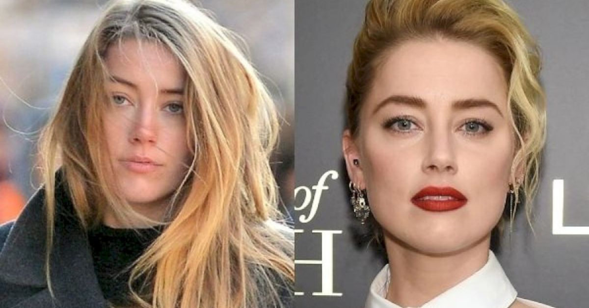 What Plastic Surgery Has Amber Heard Had?