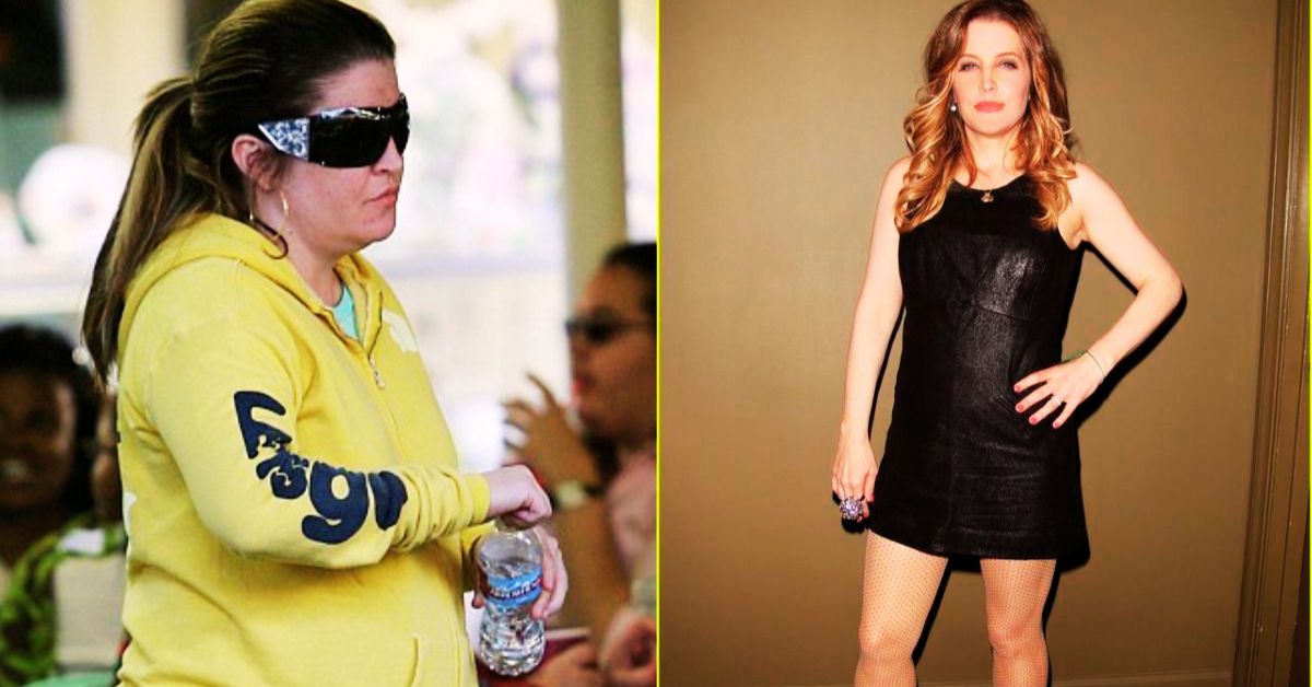 Lisa Marie Weight Loss Surgery 